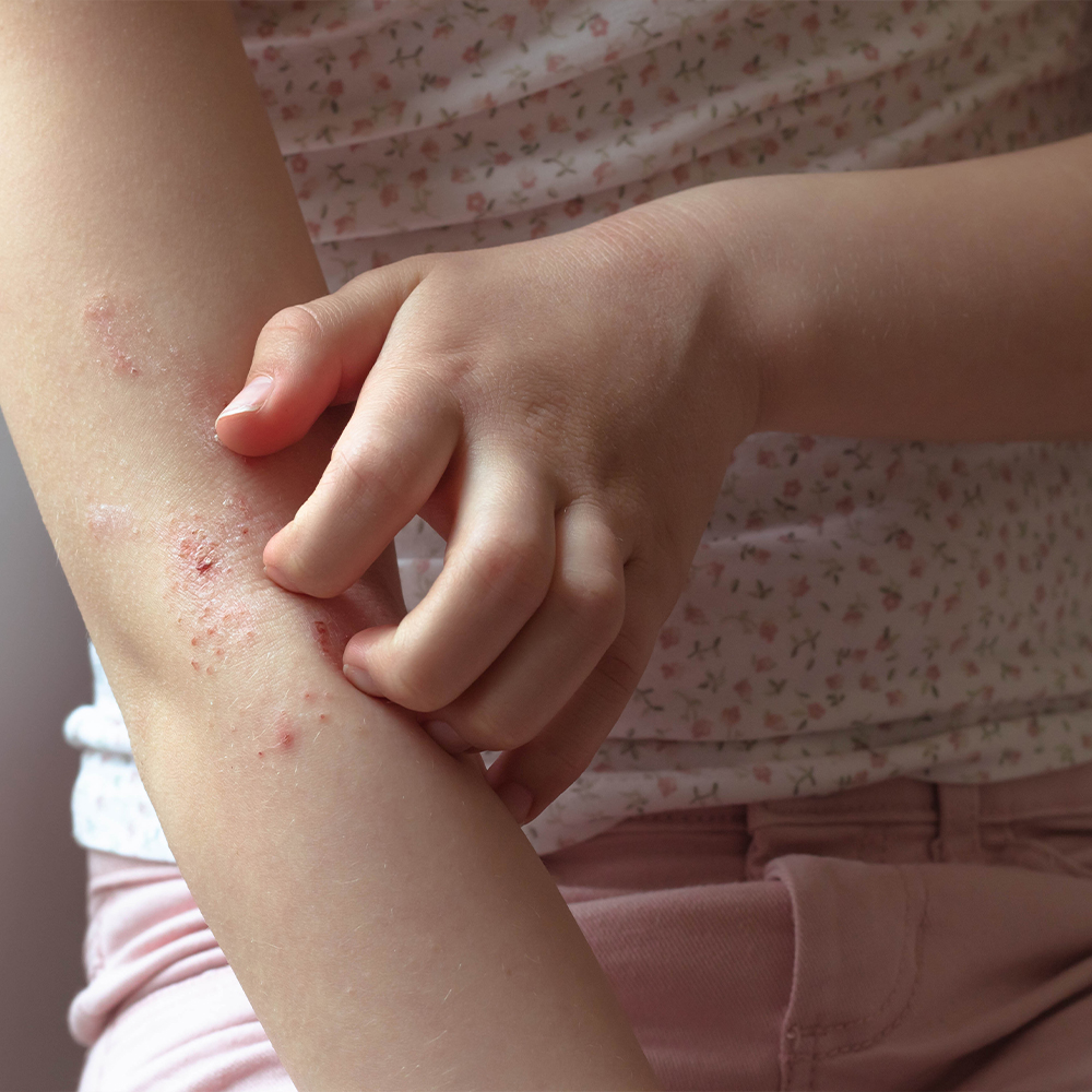 allergologie-nos-specialites